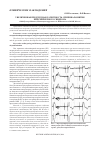 Научная статья на тему 'Увеличенная предсердная латентность - причина развития пейсмейкерного синдрома'