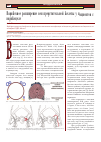 Научная статья на тему 'Варикозное расширение вен предстательной железы у пациентов с варикоцеле'