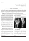 Научная статья на тему 'Varios methods of surgical treatment of benigntumors of wrist bones'