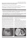 Научная статья на тему 'Видеолапароскопия в диагностике и лечении повреждений органов брюшной полости при сочетанной травме'