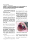Научная статья на тему 'Відкрита перфорація альвеолярного відростка верхньої щелепи, перфорація дна порожнини зуба при ендодонтичному лікуванні першого моляра верхньої щелепи (клінічний випадок)'