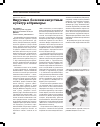 Научная статья на тему 'Вирусные болезни капустных культур в Приморье'