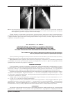 Научная статья на тему 'Влияние метода анестезии на маркеры гемостаза при эндопротезировании тазобедренного сустава на фоне профилактики низкомолекулярным гепарином'