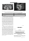 Научная статья на тему 'Влияние мукозальных гелей на биохимические маркеры воспаления и минерального обмена в слюне пациентов после дентальной имплантации'