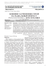 Научная статья на тему 'Влияние загрязнения серой на радиальный прирост Pinus sylvestris L. в Республике Карелия'