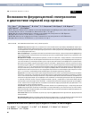 Научная статья на тему 'ВОЗМОЖНОСТИ ФЛУОРЕСЦЕНТНОЙ СПЕКТРОСКОПИИ В ДИАГНОСТИКЕ ОПУХОЛЕЙ ЛОР-ОРГАНОВ'