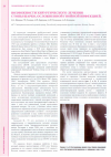 Научная статья на тему 'Возможности хирургического лечения стопы Шарко, осложненной гнойной инфекцией'