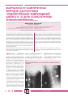 Научная статья на тему 'Возможности современных методов диагностики травматических повреждений шейного отдела позвоночника'