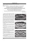 Научная статья на тему 'Вплив екологічних особливостей місцевості на діагностику та метод переміщення ретенованого зуба'