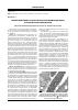 Научная статья на тему 'Вплив небівололу на ультраструктуру передсердя щурів з артеріальною гіпертензією'