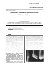 Научная статья на тему 'Выраженный хондроматоз локтевого сустава'