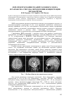 Научная статья на тему 'ЯМР-спектроскопия тканей головного мозга и разработка способа определения концентрации метаболитов'
